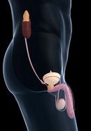 Ce analize sunt necesare pentru prostata? Ce analize sunt necesare pentru prostata?