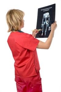 Un nou medicament pentru tratarea osteoporozei Un nou medicament pentru tratarea osteoporozei