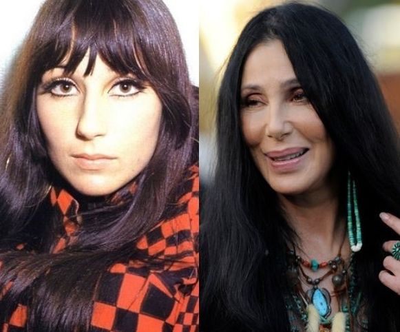 Cher