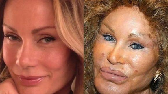 Jocelyn Wildenstein