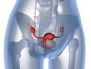 7 simptome care indica prezenta cancerului ovarian