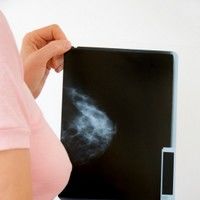 Soia previne recidiva cancerului mamar