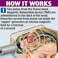 Noul dispozitiv care te scapa de migrene