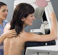 Femeile slabe, mai predispuse cancerului mamar