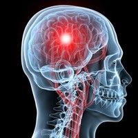 Electrostimularea creierului ii ajuta pe cei bolnavi de Parkinson