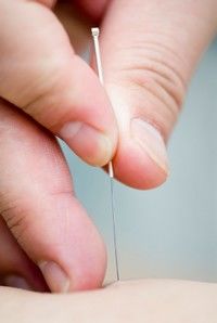 Acupunctura este eficienta in tratarea durerilor