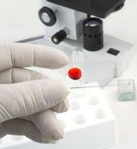 Scleroza multipla va putea fi diagnosticata printr-un simplu test de sange