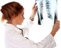 Un nou tratament pentru cancerul pulmonar