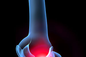 Ultrasunetele pot trata fracturile
