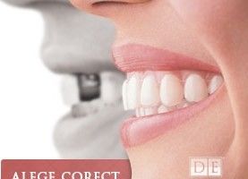 Cum iti schimba viata implantul dentar