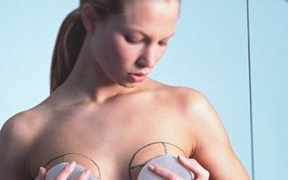 50 de ani de la primul implant mamar. Pro sau contra?