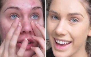 Fenomen pe YouTube: Cum scapi de acnee cu tehnici simple de machiaj