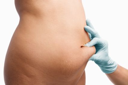 Viaţa după montarea inelului gastric: dieta postoperatorie şi noul regim zilnic