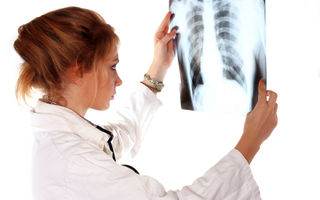 Radiografii pulmonare gratuite la clinica Anima din Bucureşti