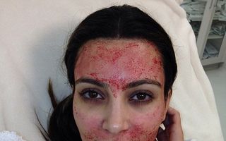 Kim Kardashian, cu sânge pe față