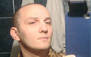 România mondenă: 6 bărbaţi disperaţi care şi-au făcut implant de păr