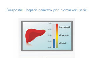 SteatoScreen, primul test complet pentru ficat, disponibil acum și în România