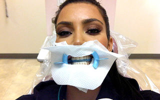 Hollywood: 7 vedete care s-au pozat la dentist. Imagini haioase!