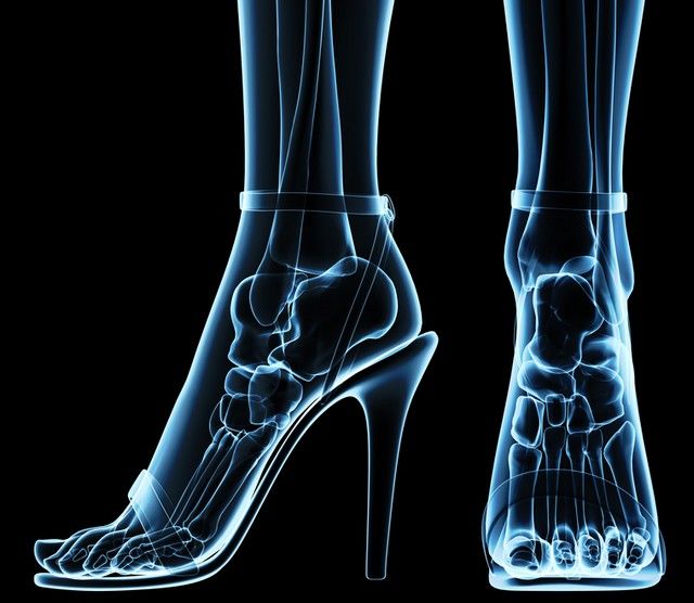 Articulațiile picioarelor mamei s-au durut Artralgie vs artrită: care este diferența?
