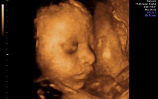 Ecografia 3D/4D, obligatorie pentru monitorizarea sarcinii