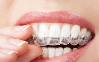 Sănătate. 4 motive pentru care scrâşneşti din dinţi