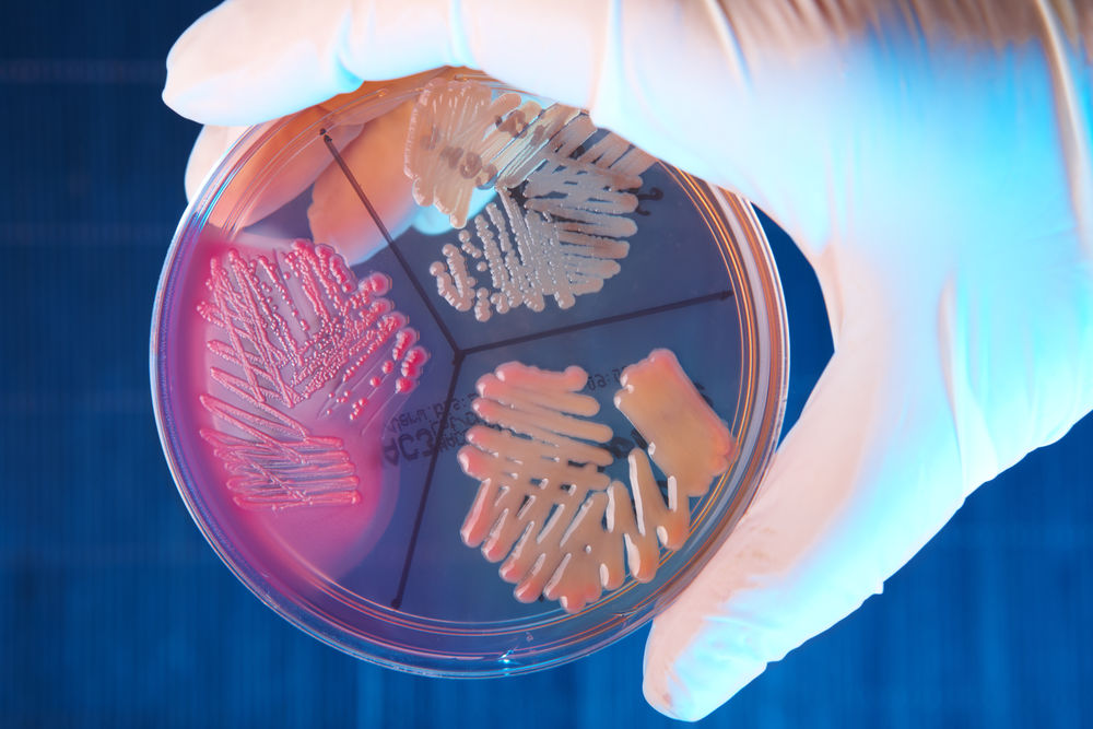 Bacterii cercetate in laborator