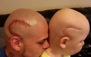 Emoţionant. Un tată și-a făcut un tatuaj asemănător cu cicatricea fiului său după operaţie