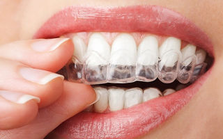 Ce efecte negative au dinții strâmbi asupra sănătăţii