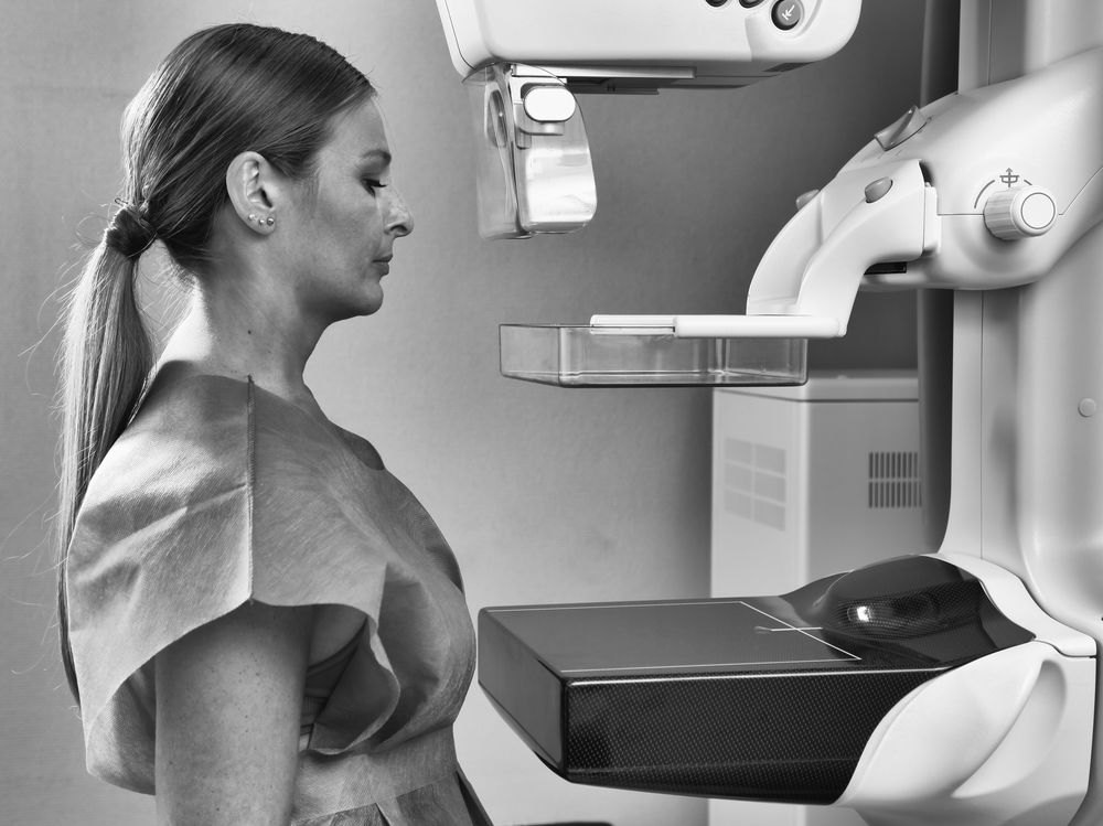Control mamografie