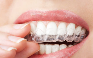 Albirea dinţilor acasă: ce metode funcţionează?