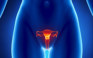 Fibromul uterin nu afectează doar femeile în vârstă! Principalele simptome