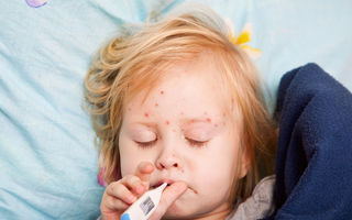 Tot ce trebuie să știi despre rujeola la copii: simptome și tratament