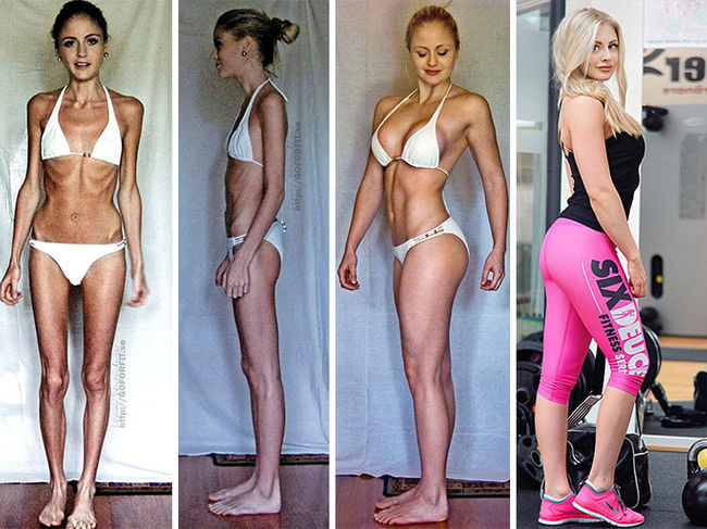 anorexie înainte și după pierderea în greutate