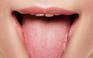 13 lucruri pe care limba încearcă să le spună despre sănătatea ta