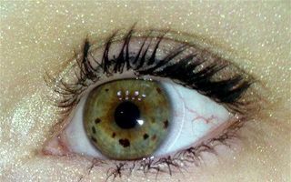 Ai puncte negre pe iris? Iată ce spun petele de pe ochi despre sănătatea ta