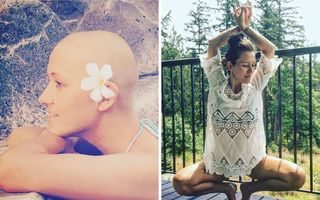 Atunci şi acum: 35 de imagini cu oameni care au învins cancerul