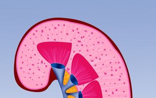 Pietrele la rinichi: cauze, simptome și tratament
