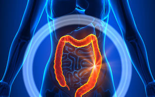 Riscul de cancer de colon creşte la persoanele cu vârsta de peste 50 de ani
