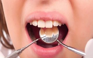 6 modalităţi eficiente de a elimina placa dentară