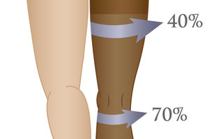 De ce să porți ciorapii compresivi - Cum îi alegi și cât să-i porți