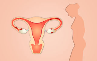 Cum te afectează endometrioza - 4 moduri neobișnuite