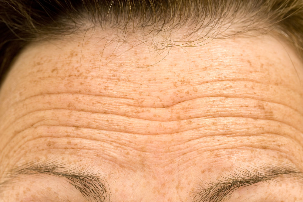 fruntea fara riduri cea mai bună cremă sub ochi pentru anti-îmbătrânire
