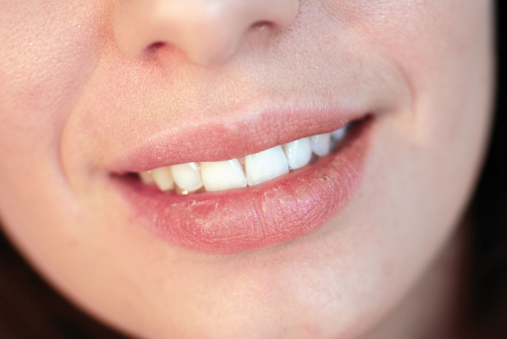 Cum să eliminați eficient ridurile din jurul gurii