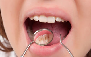 Îți sângerează gingiile? 5 remedii naturale