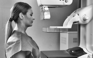 Româncele sunt diagnosticate cu cancer de sân în fază avansată, spre deosebire de femeile din restul Europei