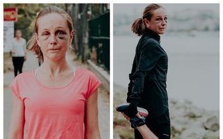 Campioană la ultramaraton, agresată sexual în Budapesta. Refuză să-și ascundă vânătăile și are un mesaj direct: „Fugi!“