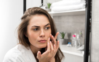 5 semne că te confrunți cu acnee de cauză hormonală