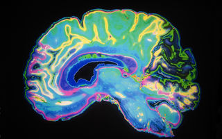 Simptomele tumorilor pe creier