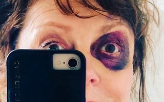 Susan Sarandon, selfie cu un ochi învinețit: Vedeta a povestit ce a pățit
