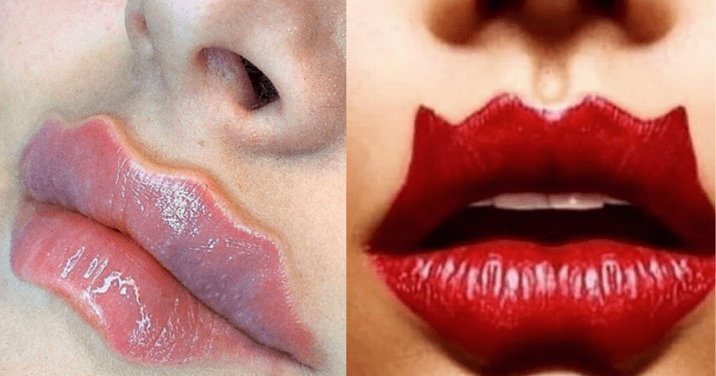 cum să vă slăbiți buzele